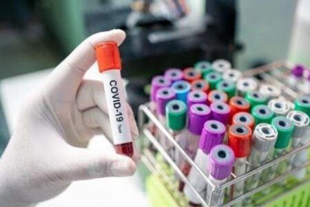تست pcr بیمه‌شدگان تامین اجتماعی رایگان می‌شود؟